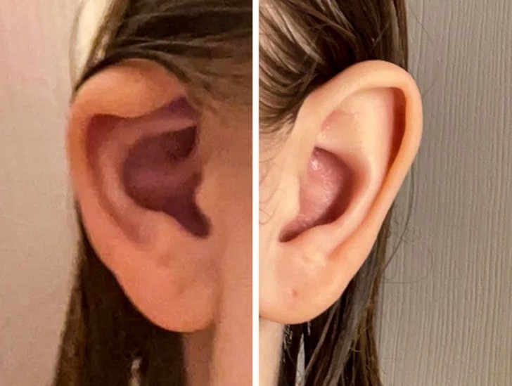 "Moje uszy różnią się od siebie."