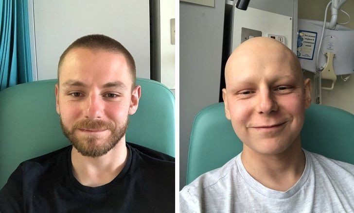 3. 3 miesiące chemioterapii
