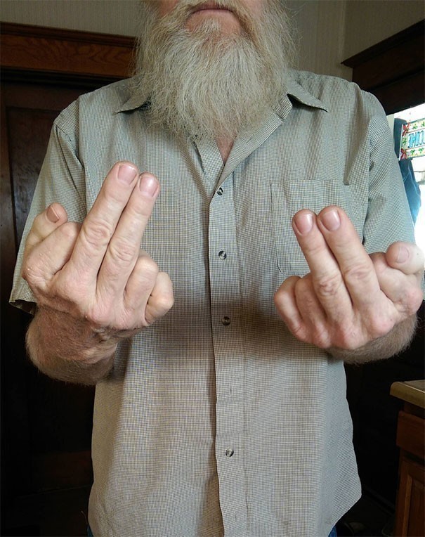 Mój tata ma 6 palców u każdej dłoni.
