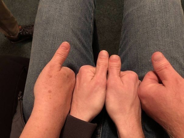Mój siostrzeniec odziedziczył kciuki od obu rodziców.
