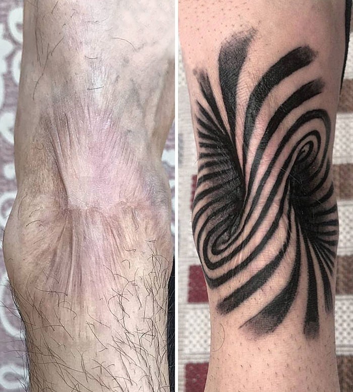 Tatuaż zakrywający bliznę