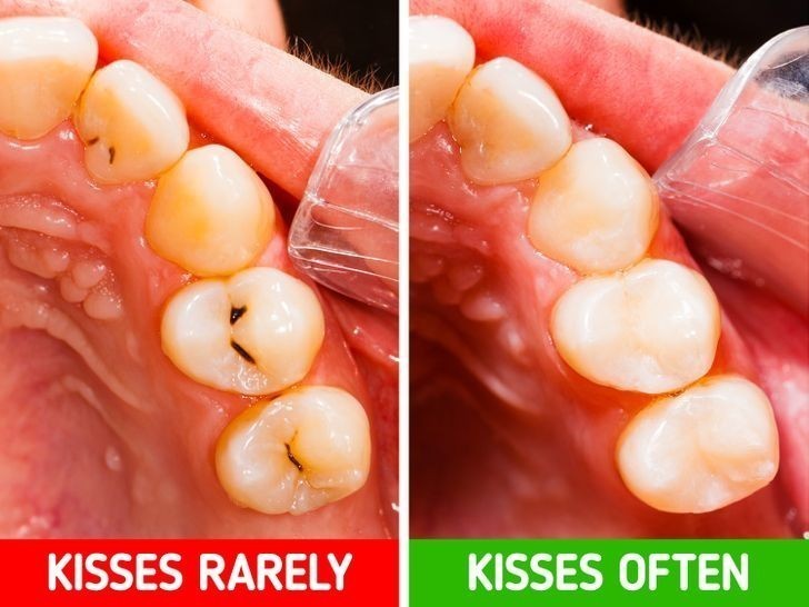 Twoje zęby będą mniej podatne na powstawanie ubytków.
