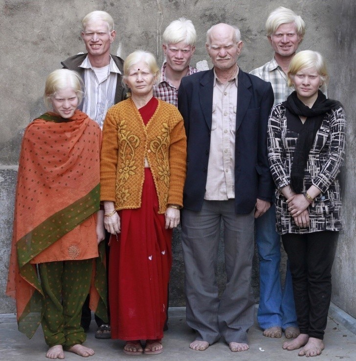 Rodzina albinosów z Indii