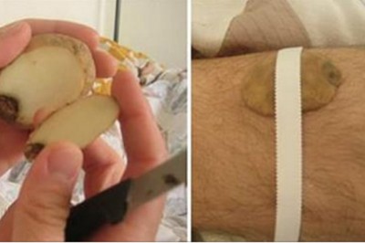 11 naturalnych lekarstw o których wiedziały nasze babcie! Poznaj naturalne metody które działają!