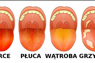 13 rzeczy które kolor Twojego języka może powiedzieć o Twoim zdrowiu! Obejrzyj go dokładnie w lustrze! 