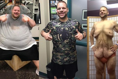 190 kg w 714 dni! Dzięki ciężkiej pracy osiągnoł coś niesamowitego ale zobacz jego skórę!