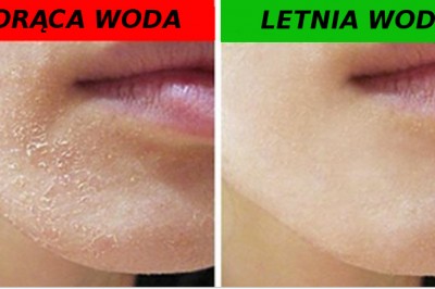 6 typowych błędów jakie popełniamy biorąc codzienny prysznic! To źle wpływa na Twoją cere! 