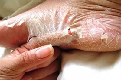 8 niezwykłych rzeczy które potrafi zrobić Twoje ciało! O większości z nich ludzie nie mają pojęcia!