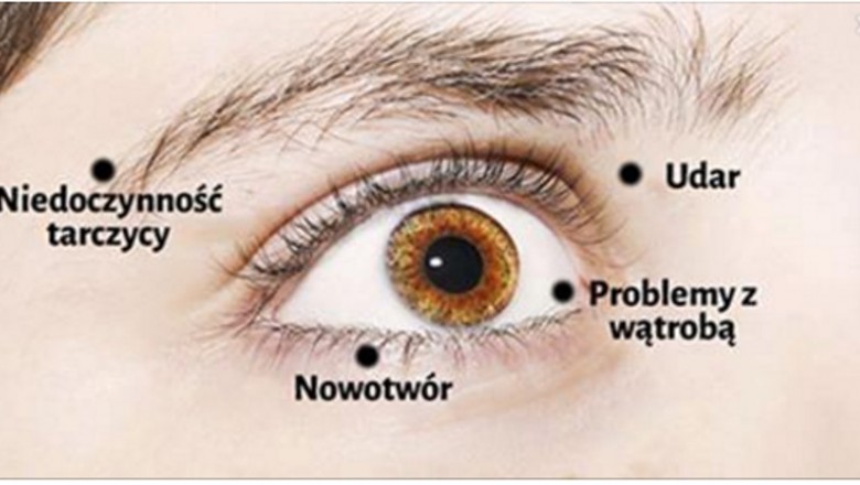8 ostrzeżeń o stanie Twojego zdrowia, które możesz wyczytać ze swoich oczu! Zwróć uwagę na to! 
