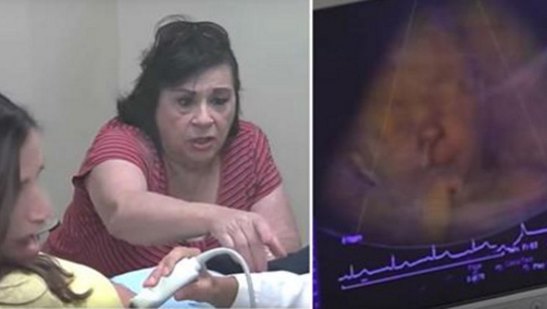 Babcia  patrzy na twarz dziecka podczas badania USG! W pewnym momencie karze córce spojrzeć! 