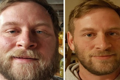 Byli uzależnieni od alkoholu ale postanowili to zmienić! Będziesz w szoku jak zmienił się ich wygląd! 