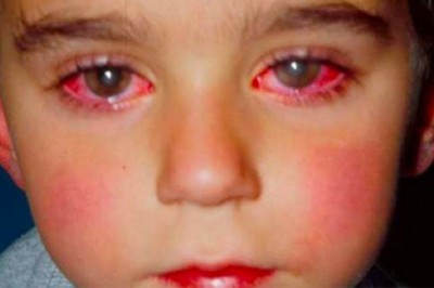 Chłopiec stracił 75% wzroku bawiąc się popularną zabawką która jest w wielu domach! Masz to w szufladzie?