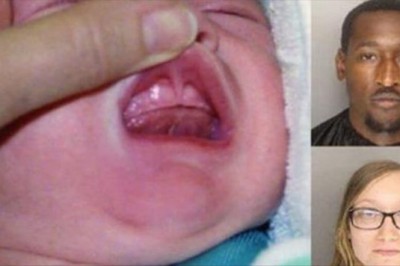 Chłopiec w złym stanie trafia na odział! Rodzice zostali aresztowani gdy policja zajrzała do ust dziecka!