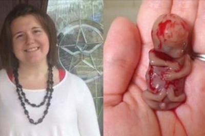 Jej dziecko przychodzi na świat w 11 tygodniu ciąży! To co miała do powiedzenia na pewno da Ci do myślenia!