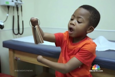 Kiedy lekarze amputowali mu dłonie i stopy nie załamał się. To co wydarzyło się później chwyta za serce! 