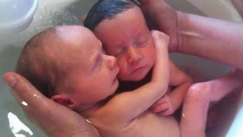 Nowo narodzone bliźniaki ciągle myślą, ze są w brzuszku mamy! Ich pierwszy kontakt ze światem rozczula!