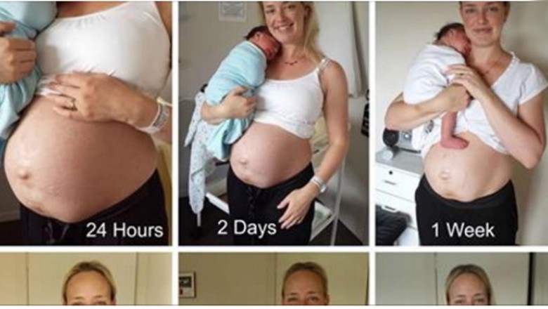 Odważna mama pokazuje zdjęcia brzucha dzień po porodzie! 14 tygodni później zupełnie się zmienia!