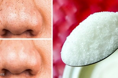 Poznaj 12 naturalnych produktów dzięki którym Twoja skóra pozostanie na zawsze młoda! To proste! 