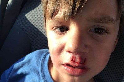 Przez głupotę rodzica popularna zabawka poważnie zraniła synka! Zobacz czego nigdy nie robić! 