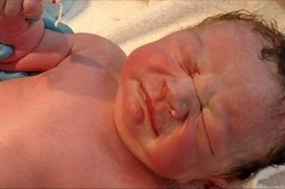 Te dziecko nigdy nie miało się urodzić! Dowód na to trzymało w swojej ręce gdy przyszło na świat! 