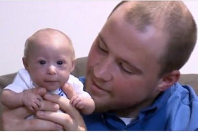 Urodził się i walczył o życie ważąc zaledwie 0,5 kg! Po 7 miesiącach nadal wygląda jak noworodek!