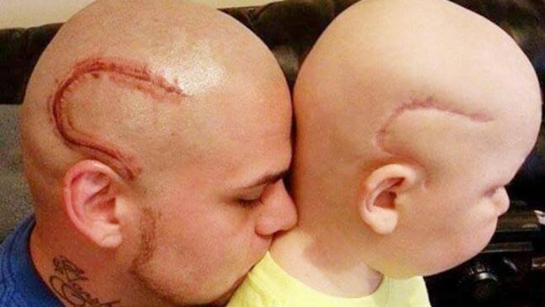 W szkole nazywali jego syna potworem! Zrobił ten niesamowity tatuaż żeby pokazać swoją miłość do dziecka!
