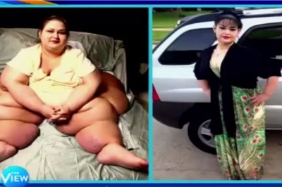 Ważąca 450 kg  kobieta podjęła walkę o normalne życie. Poznaj rezultaty!