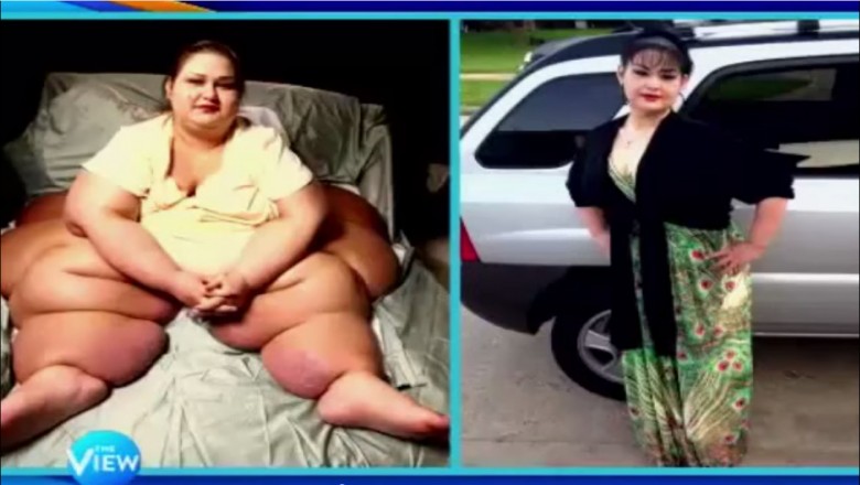 Ważąca 450 kg kobieta postanowiła walczyć o  swoje życie. Poznaj rezultaty.