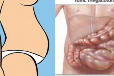 Wcale nie jesteś gruba! Zobacz jak pozbyć się wzdęć które mogą rujnować Twoją sylwetkę!