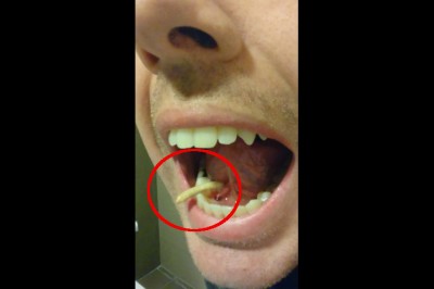 Wydawało mu się, że ma kamyk pod językiem! Gdy zaczął to wypychać byłam przerażona! 