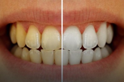 Wymieszał dwa składniki i umył tym zęby!  Efekt jest rewelacyjny i koniecznie muszę spróbować! 