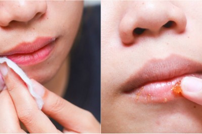 Zadbaj o swoją cerę każdego wieczora! Przeczytaj jak poprawnie usuwać makijaż!