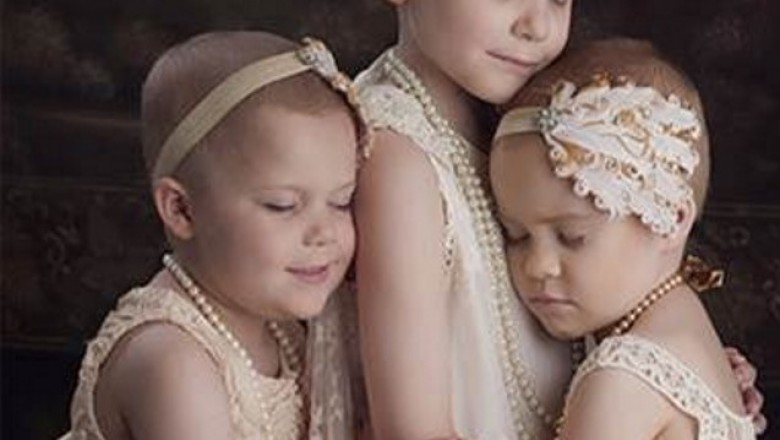 Zdjęcie 3 dziewczynek walczących z rakiem wywołało łzy! Zobacz jak wyglądają po 2 latach leczenia! 