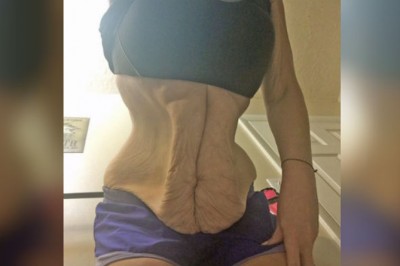 Zdjęcie brzucha tej kobiety szokowało wszystkich! W końcu postanowiła wyznać prawdę! 