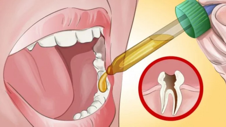 Zobacz naturalną metodę na pozbycie się ostrego bólu zęba! Nawet mój dentysta był zaskoczony! 