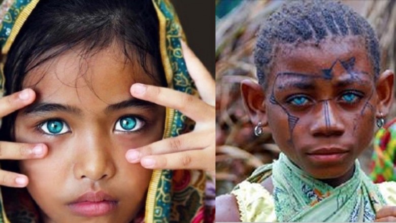 18 dzieci które posiadają najpiękniejsze kolory oczu na świecie! Będziesz zahipnotyzowana tym widokiem!