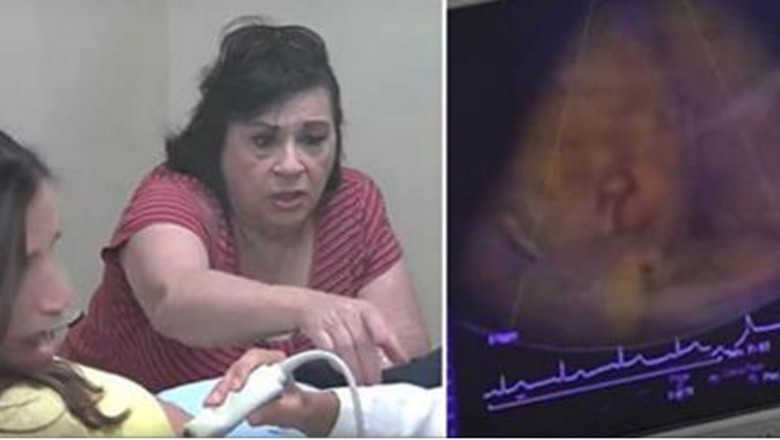 Babcia widzi twarz dziecka podczas badania USG! W pewnym momencie pyta córki co się dzieje!