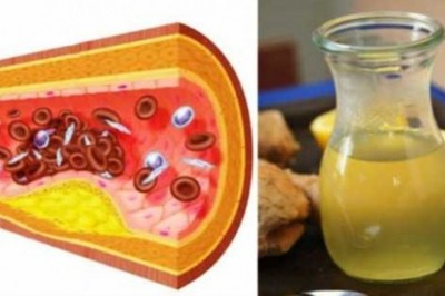 Naturalny napój który pomaga obniżyć poziom złego cholesterolu i leczy nadciśnienie! Sprawdzony sposób!