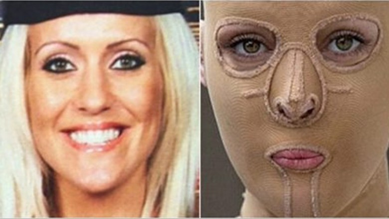 5 lat po ataku żrącą substancją zdecydowała się zdjąć maskę i pokazać światu swoją twarz
