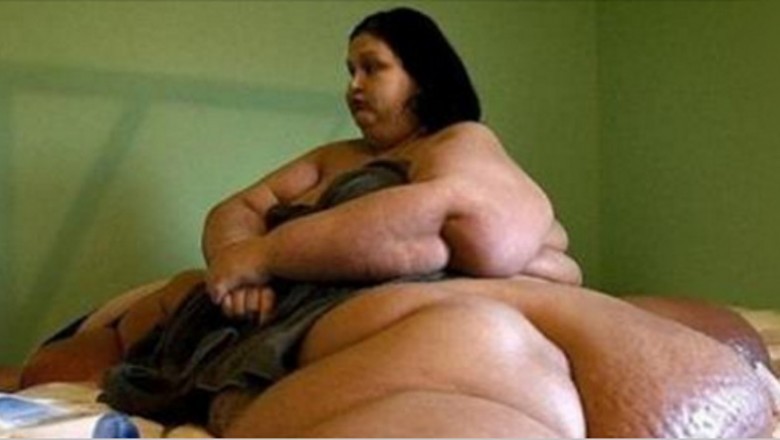 Ważyła 453 kg i była oskarżona o morderstwo! Nie uwierzysz jak wygląda po diecie i kilku operacjach!