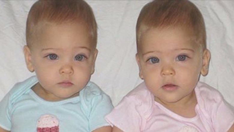 Gdy się urodziły w 2010 roku okrzyknięto je najpiękniejszymi bliźniaczkami świata! Zobacz jak wyglądają dzisiaj!