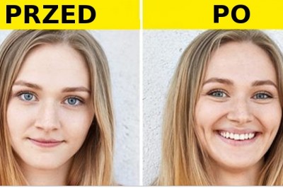 Poznaj nietypowe operacje plastyczne, które stały się bardzo modne wśród bogaczy! Zrobiłabyś to?