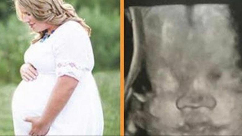 W dniu pogrzebu męża dowiedziała się, że jest w ciąży! Pół roku później lekarze odkryli coś strasznego!