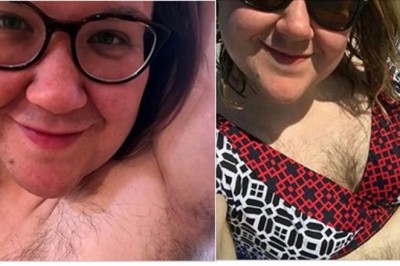 Przez lata walczyła z nadmiernym owłosieniem ciała! Wypadek zmienił jej podejście i zaakceptowała naturalny wygląd!