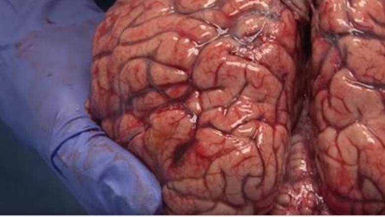 Neurobiolog pokazuje jak wygląda świeżo wyjęty z czaszki ludzki mózg! Zaskakujące jak bardzo jest delikatny! 