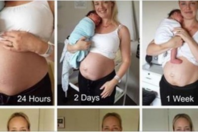 Odważna mama pokazała zdjęcia brzucha dzień po urodzeniu! 14 tygodni później zupełnie się zmienia!