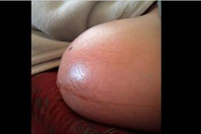 Przez skórę widać jak kopią i się wiercą! Bliźniaki walczą o miejsce w brzuchu ciężarnej mamy!