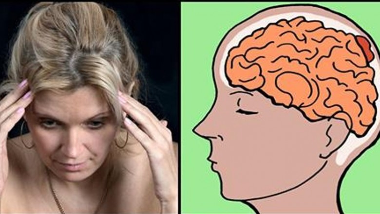Poznaj 5 objawów świadczących, że możesz mieć guz mózgu! Wcześnie wykryty nie jest śmiertelny! 