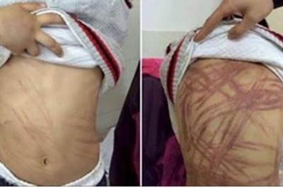 9-latek żył w prawdziwym piekle! Pod byle pretekstem matka biła go po całym ciele!