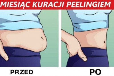 Nazywają to „wewnętrzny peeling jelit”! Dzięki  temu zabiegowi możesz zrzucić nawet 4 kg!